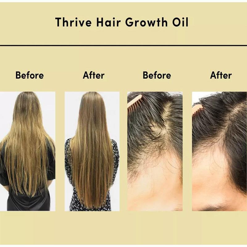 Cross-border Anti-Hair Loss Enhancement Hair Care Scalp Hair Growth Thrive Hair Oil Huanghuang Yellow Hair Care Oil